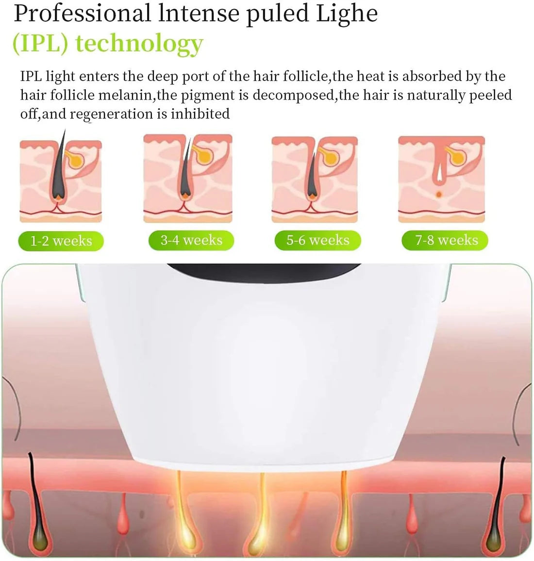 IPL Hair Removal System Silk Touch